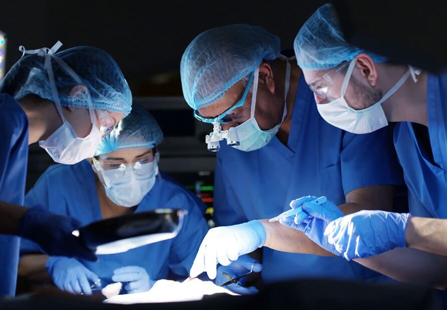 operace zvětšení penisu